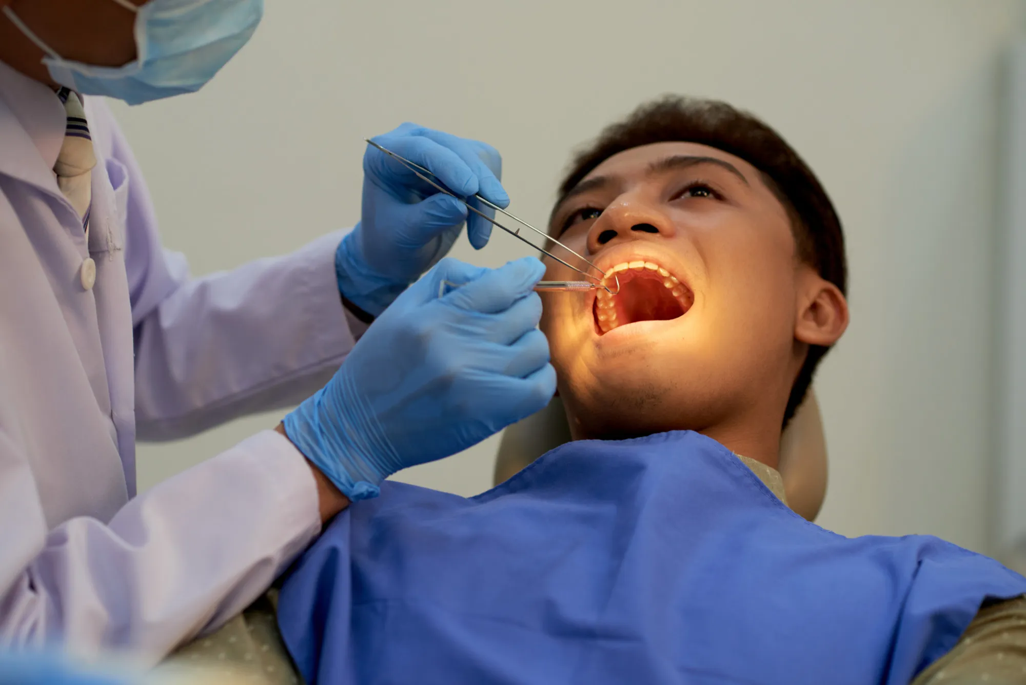 Types of Tooth Extractions: Simple vs Surgical