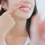 how gum grafts can protect your teeth