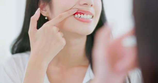 how gum grafts can protect your teeth