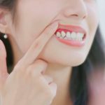 stages of gum disease