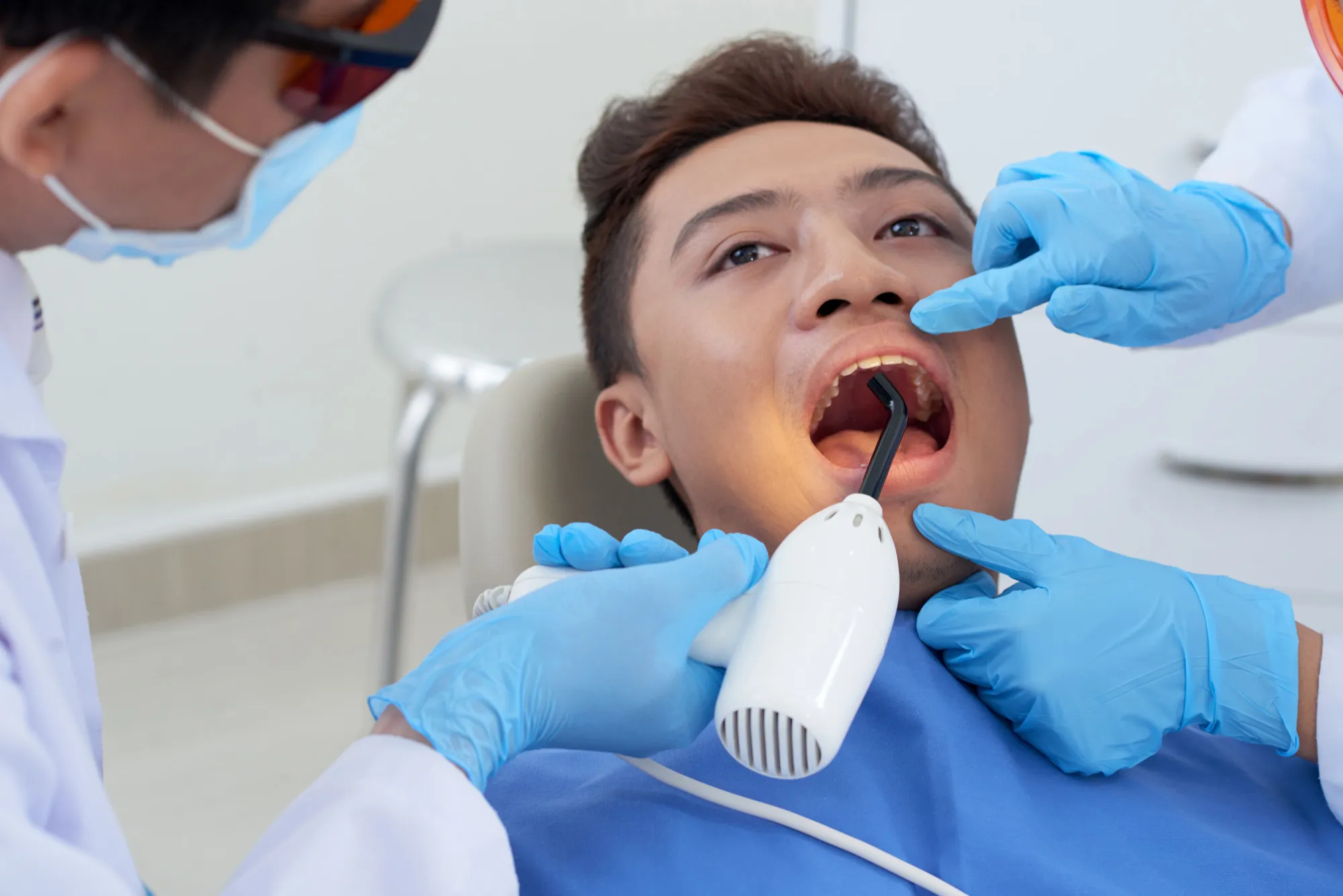 laser-frenectomy-near-you